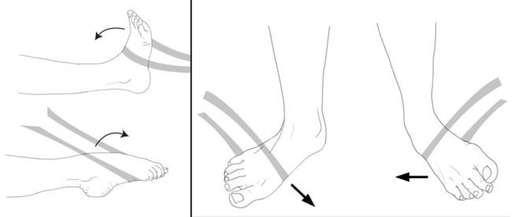 Resistance exercises after ankle sprain