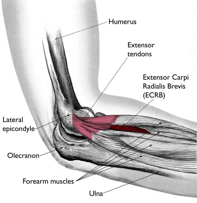ECRB muscle and tendon
