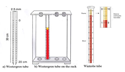 https://www.onlinebiologynotes.com/wp-content/uploads/2018/08/westergren-tube-wintrobe-tube.jpg